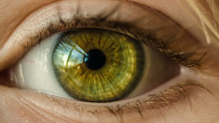 Auge